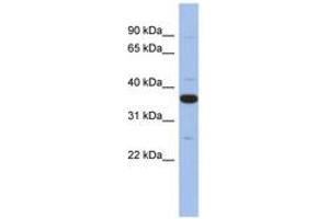 Image no. 1 for anti-Myeloid Differentiation Primary Response Gene (88) (MYD88) (AA 215-264) antibody (ABIN6744059) (MYD88 抗体  (AA 215-264))
