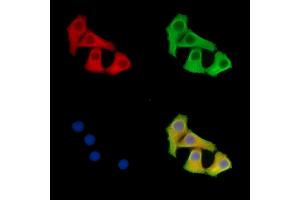ABIN7095824 and ABIN7099886 staining Hela cells by IF/ICC. (SYDE1 抗体)