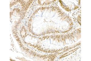 Immunohistochemistry (IHC) image for anti-Glyceraldehyde-3-Phosphate Dehydrogenase (GAPDH) (AA 150-200) antibody (ABIN7454519) (GAPDH 抗体  (AA 150-200))