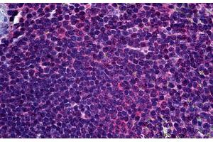 Anti-FADS1 antibody IHC staining of human spleen. (FADS1 抗体  (AA 1-100))