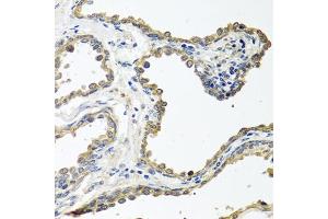 Immunohistochemistry of paraffin-embedded human prostate using COLEC11 antibody (ABIN6130117, ABIN6138854, ABIN6138855 and ABIN6220812) at dilution of 1:100 (40x lens). (COLEC11 抗体  (AA 26-271))