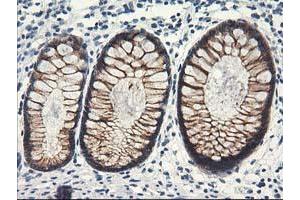 Immunohistochemical staining of paraffin-embedded Human colon tissue using anti-NAPEPLD mouse monoclonal antibody. (NAPEPLD 抗体)
