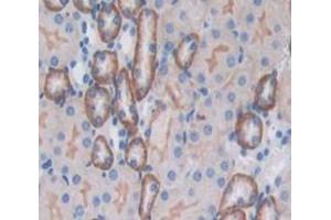 Used in DAB staining on fromalin fixed paraffin- embedded Kidney tissue (CD164 抗体  (AA 24-162))