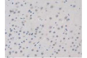 IHC-P analysis of Mouse Brain Tissue, with DAB staining. (BRD8 抗体  (AA 797-951))
