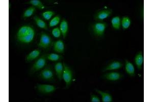 Immunofluorescence staining of A549 cells with ABIN7163287 at 1:100, counter-stained with DAPI.