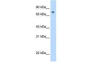 WB Suggested Anti-STAT1 Antibody Titration: 0. (STAT1 抗体  (N-Term))