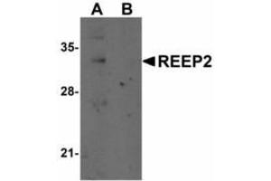 Image no. 1 for anti-Receptor Accessory Protein 2 (REEP2) (Internal Region) antibody (ABIN478103) (REEP2 抗体  (Internal Region))