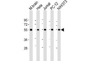 All lanes : Anti-beta II Tubulin at 1:8000 dilution Lane 1: mouse brain lysate Lane 2: Hela whole cell lysate Lane 3: Jurkat whole cell lysate Lane 4: PC-12 whole cell lysate Lane 5: NIH/3T3 whole cell lysate Lysates/proteins at 20 μg per lane. (TUBB2A 抗体  (AA 14-46))