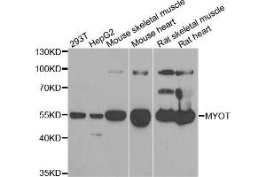 Western blot analysis of extracts of various cell lines, using MYOT antibody (ABIN5973839) at 1/1000 dilution. (Myotilin 抗体)