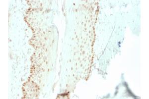 Formalin-fixed, paraffin-embedded human cervix stained with SOX2 Recombinant Mouse Monoclonal Antibody (rSOX2/1792).