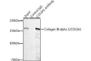 Immunoprecipitation (IP) image for anti-Collagen, Type III (COL3) antibody (ABIN7266459)