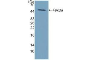 Detection of Recombinant SPINT2, Human using Polyclonal Antibody to Serine Peptidase Inhibitor Kunitz Type 2 (SPINT2) (SPINT2 抗体  (AA 28-197))