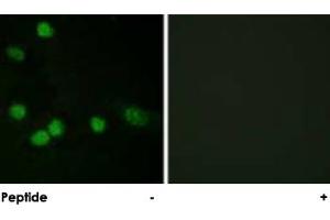 Immunofluorescence analysis of HeLa cells, using RAF1 polyclonal antibody . (RAF1 抗体)