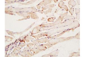 Formalin-fixed and paraffin embedded rat muscle labeled with Rabbit Anti-CNTF Receptor alpha Polyclonal Antibody at 1:200 followed by conjugation to the secondary antibody and DAB staining (CNTF Receptor alpha 抗体  (AA 151-160))