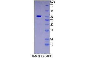 SDS-PAGE analysis of Mouse FUCa1 Protein. (FUCA1 蛋白)
