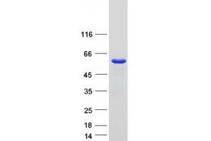 Western Blotting (WB) image for Sorting Nexin 17 (SNX17) protein (Myc-DYKDDDDK Tag) (ABIN2732397)