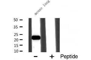 Western blot analysis of CSRP1 expression in Mouse lung lysate (CSRP1 抗体  (Internal Region))