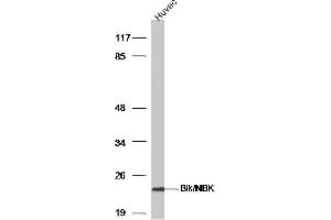 HUVEC lysates probed with Bik/NBK Polyclonal Antibody, Unconjugated  at 1:300 dilution and 4˚C overnight incubation. (BIK 抗体  (AA 10-90))