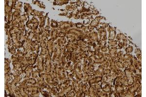 ABIN6274770 at 1/100 staining Rat kidney tissue by IHC-P. (RPL17 抗体  (C-Term))