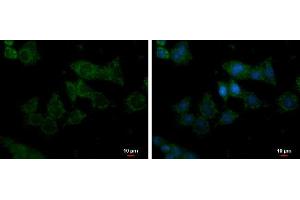 ICC/IF Image Glycerol kinase antibody [N3C2], Internal detects Glycerol kinase protein at mitochondria by immunofluorescent analysis. (Glycerol Kinase 抗体)