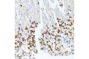 Immunohistochemistry of paraffin-embedded mouse stomach using GPM6A antibody. (GPM6A 抗体)