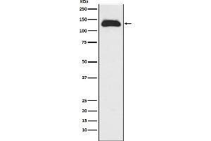 Western blot analysis of Eg5 expression in Raji cell lysate. (Recombinant KIF11 抗体)