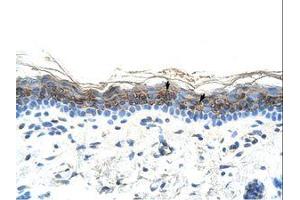 Image no. 1 for anti-ZIC2 (ZIC2) (AA 446-495) antibody (ABIN6736299) (ZIC2 抗体  (AA 446-495))