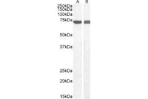 ABIN2560986 (0. (AIF 抗体)