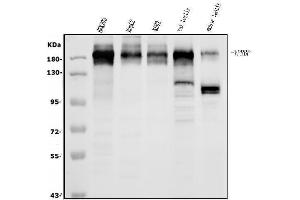 Western blot analysis of VPRBP/DCAF1 using anti-VPRBP/DCAF1 antibody (ABIN7599063). (DDB1 and CUL4-Associated Factor 1 (DCAF1) (AA 1-195) 抗体)