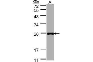 WB Image Sample (30 ug of whole cell lysate) A: Hep G2 , 12% SDS PAGE antibody diluted at 1:1000 (LITAF 抗体)