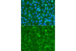 Immunofluorescence analysis of A549 cells using NCK1 antibody. (NCK1 抗体)