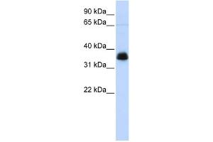 WB Suggested Anti-AIP Antibody Titration: 0.