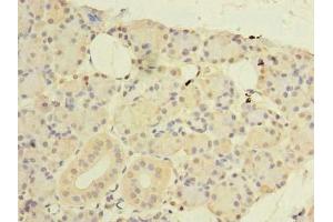 Immunohistochemistry of paraffin-embedded human pancreatic tissue using ABIN7148768 at dilution of 1:100 (CWF19L1 抗体  (AA 101-330))