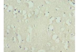 Immunohistochemistry of paraffin-embedded human brain tissue using ABIN7157650 at dilution of 1:100 (KIF3A 抗体  (AA 430-699))