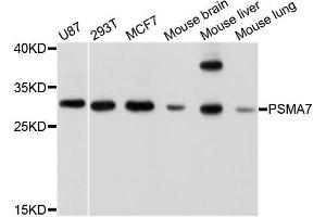 Western blot analysis of extracts of various cell lines, using PSMA7 antibody. (PSMA7 抗体  (AA 1-248))