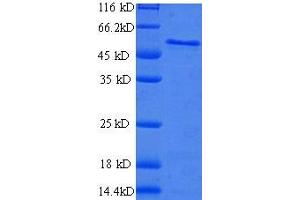 B-Cell Receptor-Associated Protein 31 (BCAP31) (AA 2-243), (partial) protein (GST tag) (BCAP31 Protein (AA 2-243, partial) (GST tag))