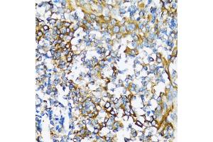 Immunohistochemistry of paraffin-embedded human tonsil using NFKB1 antibody (ABIN6292205) at dilution of 1:100 (40x lens). (NFKB1 抗体)