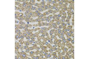 Immunohistochemistry of paraffin-embedded rat liver using EPO antibody. (EPO 抗体)