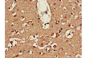 Immunohistochemistry of paraffin-embedded human brain tissue using ABIN7164586 at dilution of 1:100 (ATP9A 抗体  (AA 2-69))