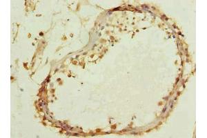 Immunohistochemistry of paraffin-embedded human testis tissue using ABIN7171911 at dilution of 1:100 (TTC16 抗体  (AA 551-873))