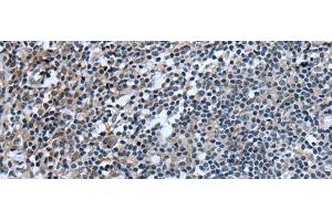 Immunohistochemistry of paraffin-embedded Human tonsil tissue using UGT8 Polyclonal Antibody at dilution of 1:55(x200) (UGT8 抗体)