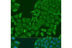 Immunofluorescence analysis of U2OS cells using ABCF2 Polyclonal Antibody at dilution of 1:100. (ABCF2 抗体)