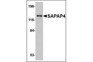 Western blot analysis of SAPAP4 in SK-N-SH cell lysate with this product at 1 μg/ml. (DLGAP4 抗体  (Center))