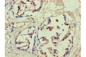 Immunohistochemistry of paraffin-embedded human prostate tissue using ABIN7152936 at dilution of 1:100 (Filaggrin 抗体  (AA 3838-4061))