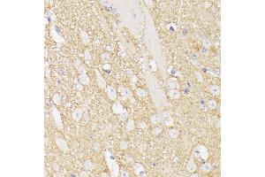 Immunohistochemistry (IHC) image for anti-Septin 5 (SEPT5) (AA 1-369) antibody (ABIN6147556)
