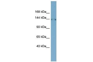 WB Suggested Anti-FAM135B Antibody Titration: 0. (FAM135B 抗体  (Middle Region))