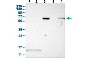 Western Blot analysis with JPH1 polyclonal antibody . (Junctophilin 1 抗体  (AA 528-629))