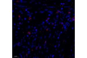 Immunofluorescence (Paraffin-embedded Sections) (IF (p)) image for anti-Mucosal Vascular Addressin Cell Adhesion Molecule 1 (MADCAM1) antibody (ABIN7074695)