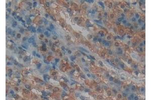 Detection of RANk in Rat Intestine Tissue using Polyclonal Antibody to Receptor Activator Of Nuclear Factor Kappa B (RANk)