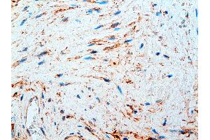 Immunohistochemistry (IHC) image for anti-Plasma Fibronectin antibody (ABIN108418) (Plasma Fibronectin 抗体)